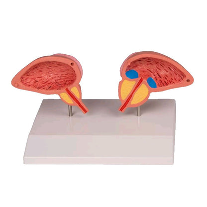 Anatomisches Prostata-Modell, 2-teilig: Querschnittshälften auf Sockel, 3/4