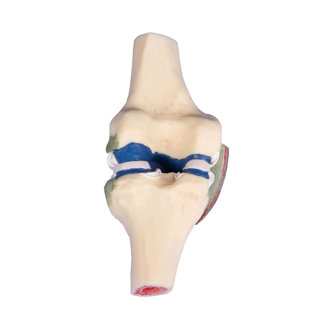Lebensgroßes Knie-Gelenkschnittmodell, seitliche Ansicht mit blauen Bändern