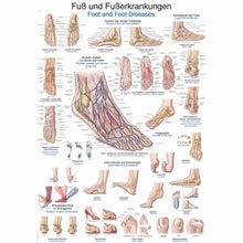 Lehrtafel Fuß und Fußerkrankungen: farbige Anatomie-Illustrationen und Diagramme