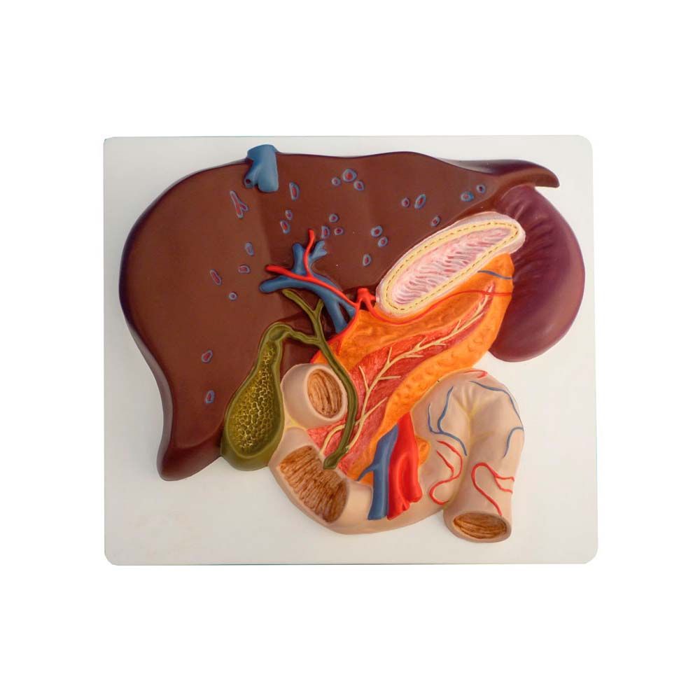 Erler Zimmer anatomisches Modell: Leber mit Gallenblase, Pankreas und Duodenum