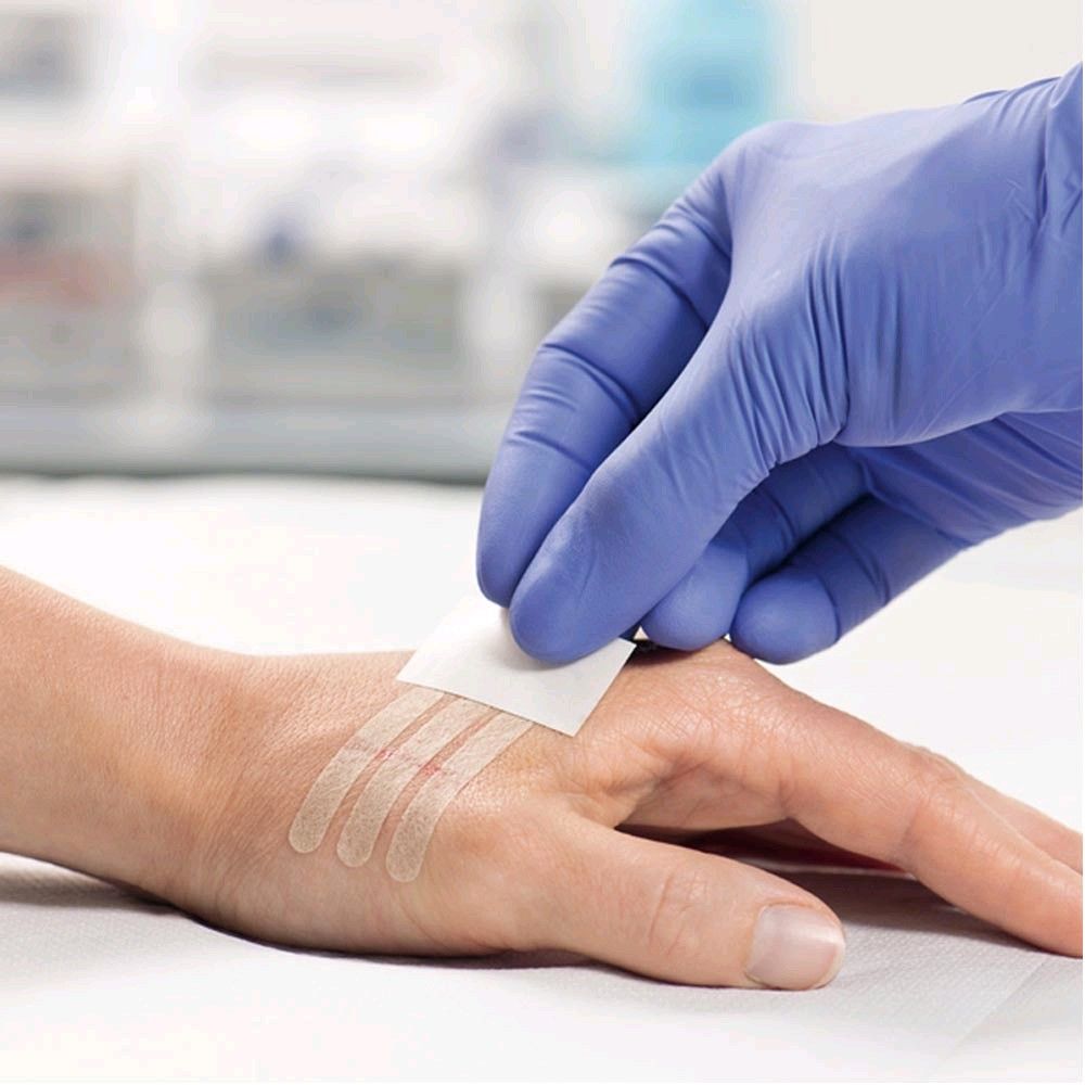 Sterile Wundnahtstreifen am Unterarm, Pflasterstreifen werden aufgeklebt
