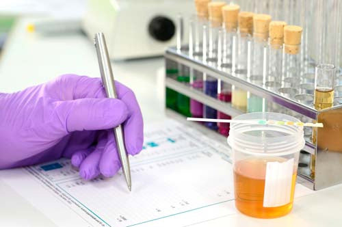 Laboratorio per test antidroga