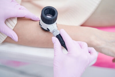 Un medico utilizza il dermatoscopio per esaminare la pelle